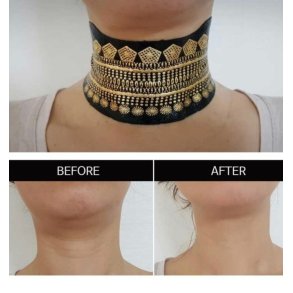 Hals maske - standart