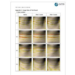 Hals maske - standart