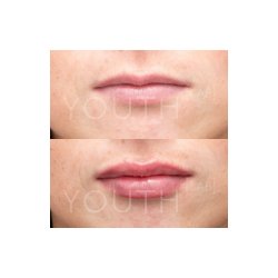 Lip Plump YL pr. stk.